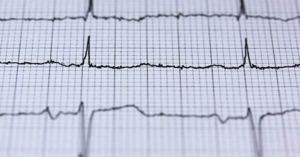 découvrez le diagnostic électrique : une analyse approfondie de vos systèmes électriques pour identifier les pannes, optimiser le fonctionnement et assurer la sécurité de vos installations. faites appel à des experts pour des solutions efficaces et durables.