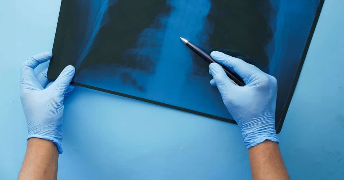 découvrez l'art de l'analyse technique, une méthode cruciale pour évaluer les mouvements des marchés financiers. apprenez à interpréter les graphiques, identifier les tendances et prendre des décisions éclairées pour vos investissements.